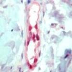 FLI1 Antibody in Immunohistochemistry (IHC)