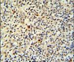 FLI1 Antibody in Immunohistochemistry (IHC)