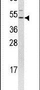 FLI1 Antibody in Western Blot (WB)