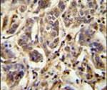 AAGAB Antibody in Immunohistochemistry (IHC)