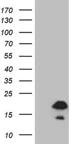 FLJ33360 Antibody in Western Blot (WB)