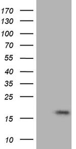 FLJ33360 Antibody in Western Blot (WB)