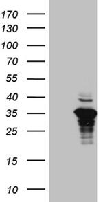 FLJ40504 Antibody in Western Blot (WB)
