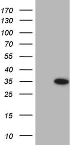 FLJ40504 Antibody in Western Blot (WB)