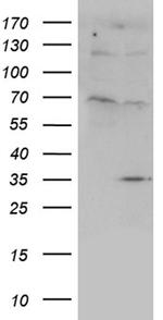 FLJ40504 Antibody in Western Blot (WB)