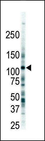 FLT3 Antibody in Western Blot (WB)