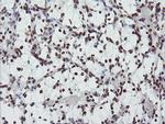FMR1 Antibody in Immunohistochemistry (Paraffin) (IHC (P))