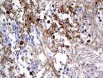 FN1 Antibody in Immunohistochemistry (Paraffin) (IHC (P))