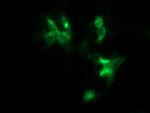 FNDC4 Antibody in Immunocytochemistry (ICC/IF)