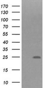 FNDC4 Antibody in Western Blot (WB)