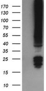 FNDC4 Antibody in Western Blot (WB)