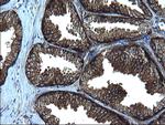 FNDC8 Antibody in Immunohistochemistry (Paraffin) (IHC (P))