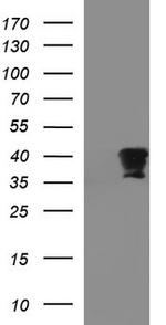 FNDC8 Antibody in Western Blot (WB)