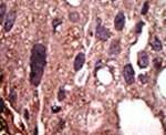 FNTB Antibody in Immunohistochemistry (IHC)