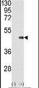 FNTB Antibody in Western Blot (WB)