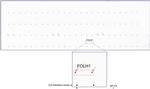FOLH1 Antibody in Peptide array (ARRAY)