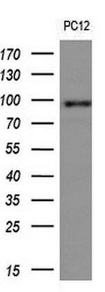 FOLH1 Antibody in Western Blot (WB)
