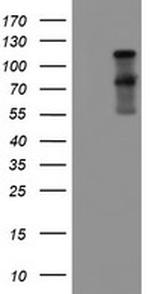FOLH1 Antibody in Western Blot (WB)