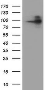 FOLH1 Antibody in Western Blot (WB)