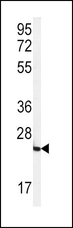 FOLR2 Antibody in Western Blot (WB)