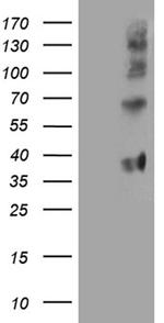 FOLR3 Antibody in Western Blot (WB)