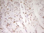 FOS Antibody in Immunohistochemistry (Paraffin) (IHC (P))