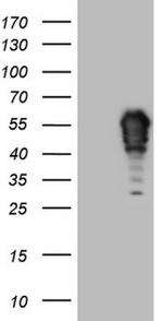 FOS Antibody in Western Blot (WB)