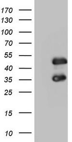 FOSB Antibody in Western Blot (WB)