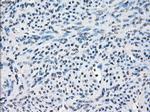 FOSL1 Antibody in Immunohistochemistry (Paraffin) (IHC (P))