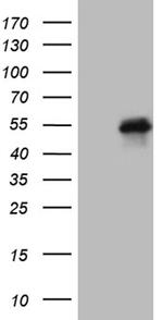 FOSL2 Antibody in Western Blot (WB)