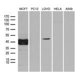 FOSL2 Antibody in Western Blot (WB)