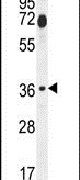 Fra2 Antibody in Western Blot (WB)