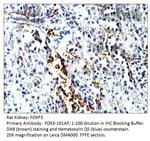FOXP3 Antibody in Immunohistochemistry (IHC)