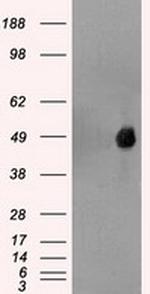 FOXA1 Antibody in Western Blot (WB)