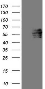 FOXC2 Antibody in Western Blot (WB)