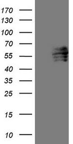 FOXC2 Antibody in Western Blot (WB)