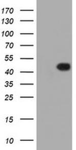 FOXI1 Antibody in Western Blot (WB)