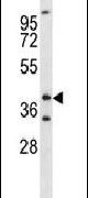 FOXL1 Antibody in Western Blot (WB)