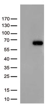 FOXN2 Antibody in Western Blot (WB)