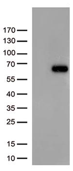 FOXN2 Antibody in Western Blot (WB)