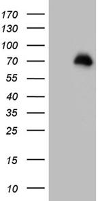 FOXO1 Antibody in Western Blot (WB)