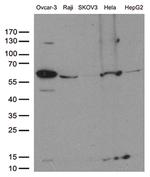 FOXO1 Antibody in Western Blot (WB)