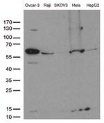 FOXO1 Antibody in Western Blot (WB)