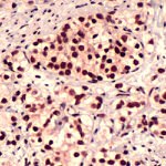 FOXO1 Polyclonal Antibody