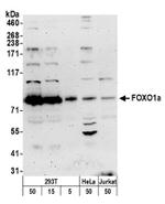 FOXO1a Antibody in Western Blot (WB)