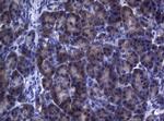 FOXO3 Antibody in Immunohistochemistry (Paraffin) (IHC (P))