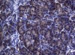 FOXO3 Antibody in Immunohistochemistry (Paraffin) (IHC (P))