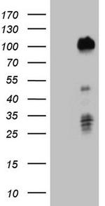 FOXO3 Antibody in Western Blot (WB)