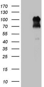 FOXO3 Antibody in Western Blot (WB)