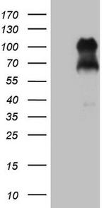 FOXO3 Antibody in Western Blot (WB)